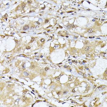 PSMA7 antibody