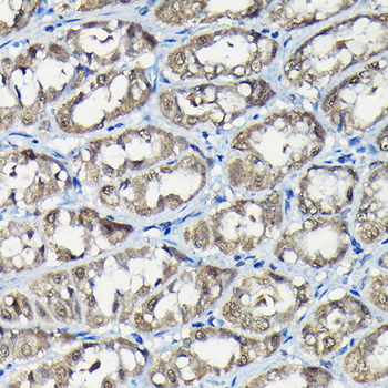 USP5 antibody