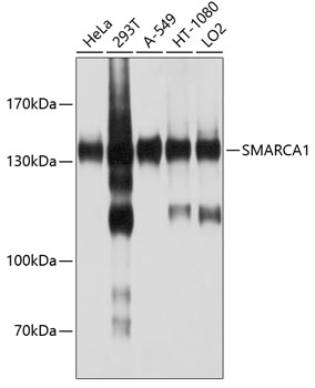 SMARCA1 antibody