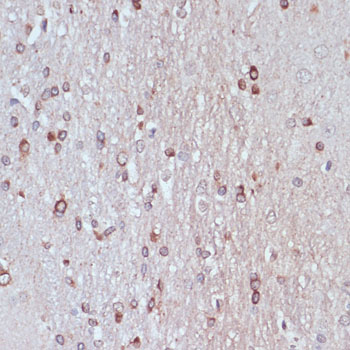 TPD52 antibody