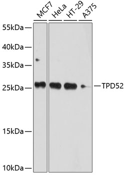 TPD52 antibody