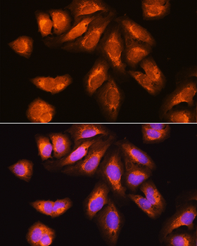 EXOSC2 antibody