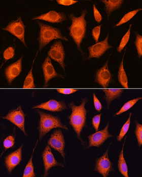 EXOSC2 antibody