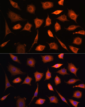 PHGDH antibody