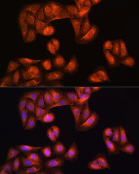 PHGDH antibody