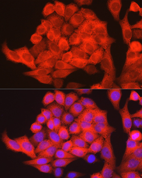 PHGDH antibody