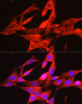 PHGDH antibody