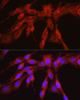 PHGDH antibody