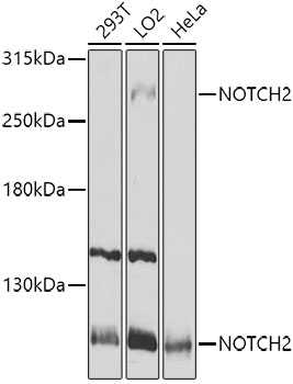 NOTCH2 antibody