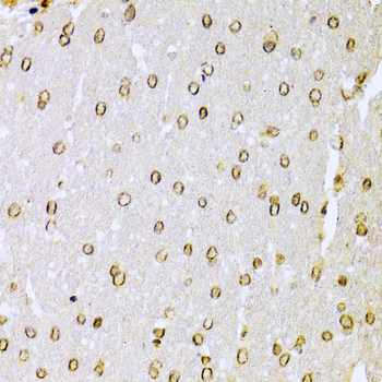 XRCC6 antibody