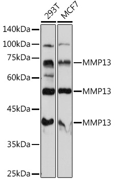 MMP13 antibody