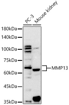 MMP13 antibody