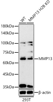 MMP13 antibody