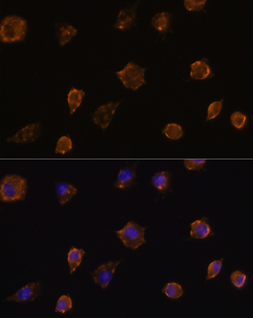 MMP13 antibody