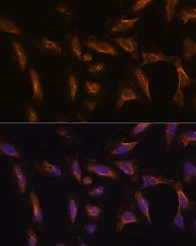 MMP13 antibody