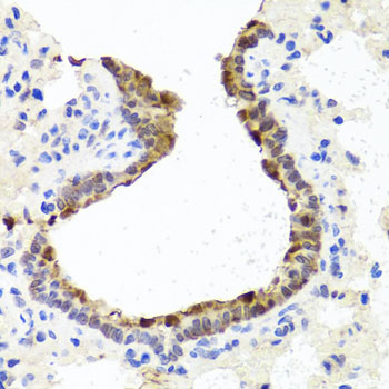 TOPBP1 antibody