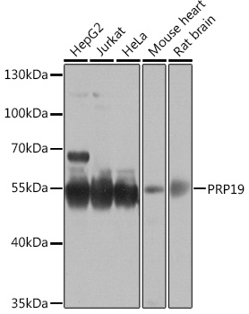 PRPF19 antibody