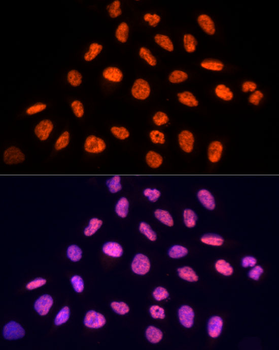 PRPF19 antibody