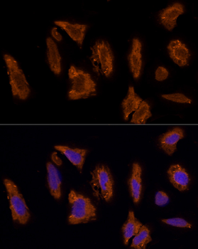 SCARB2 antibody