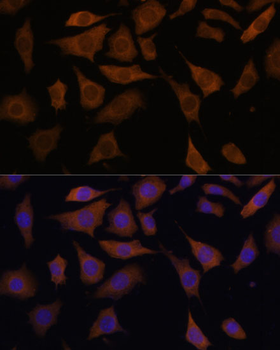 PGK2 antibody