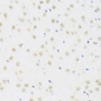 DDX50 antibody