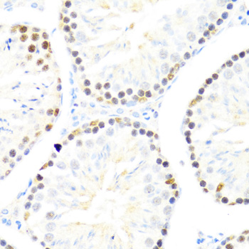 DDX50 antibody