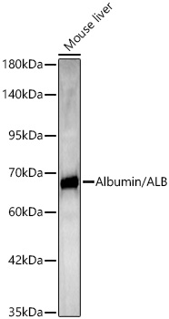 ALB antibody