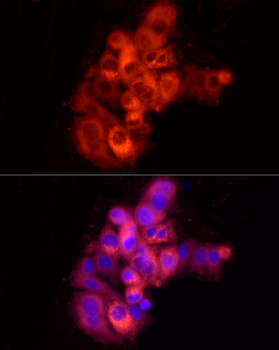 ALB antibody