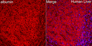 ALB antibody