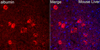 ALB antibody