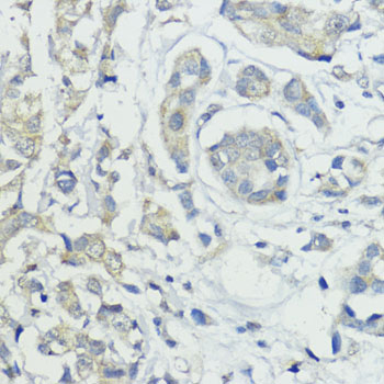 BMPR1B antibody