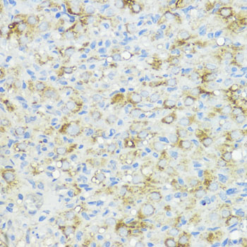 BMPR1B antibody