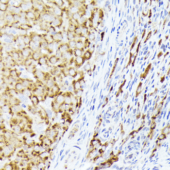 BMPR1B antibody