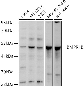 BMPR1B antibody