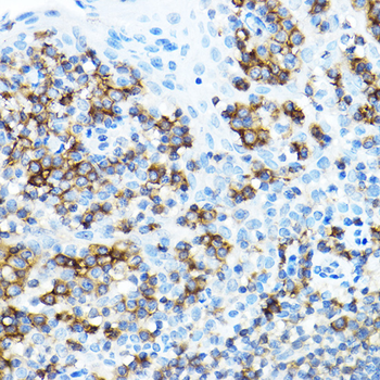 CD27 antibody