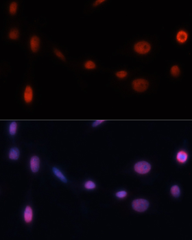 CDKN1A antibody