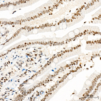 CDKN1A antibody