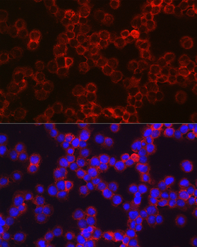 CHI3L1 antibody