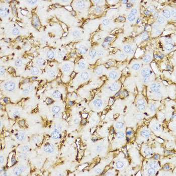 CHI3L1 antibody