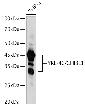 CHI3L1 antibody