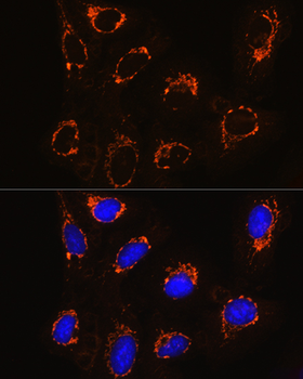 MAOB antibody