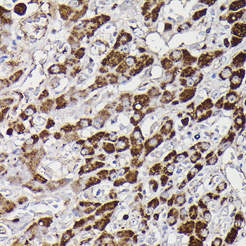 MAOB antibody