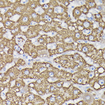 MAOB antibody