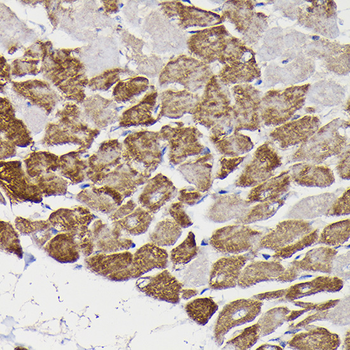 MAOB antibody