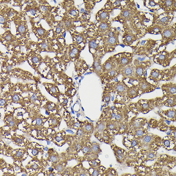 MAOB antibody