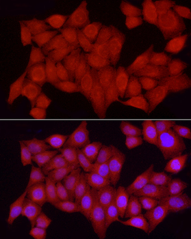 PTPN2 antibody