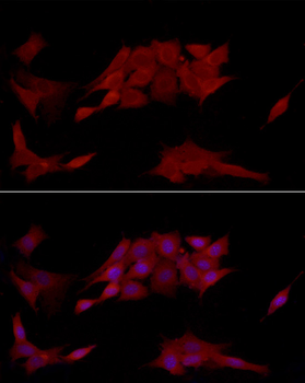 PTPN2 antibody