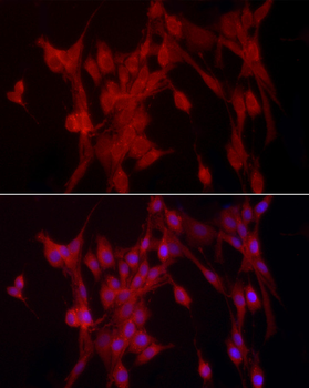 PTPN2 antibody