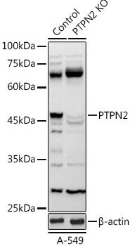 PTPN2 antibody