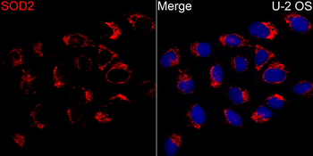 SOD2 antibody